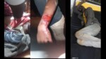 “راديو دبنقا ” يرصد تفاصيل أحداث معسكر اللاجئين بأوغندا
