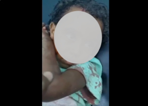 طفلة أصيبت في قصف لمستشفى يشفين في نيالا