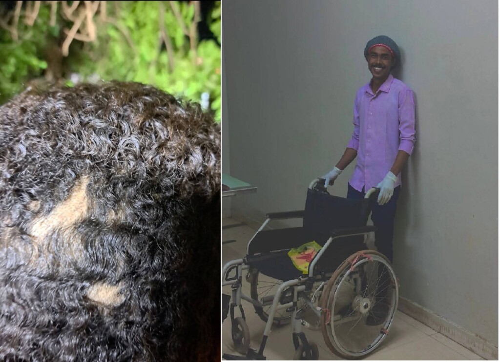 متطوع في مستشفى النو بأمدرمان جرى الاعتداء عليه بواسطة قوات نظامية- اكتوبر 2025-وسائل التواصل